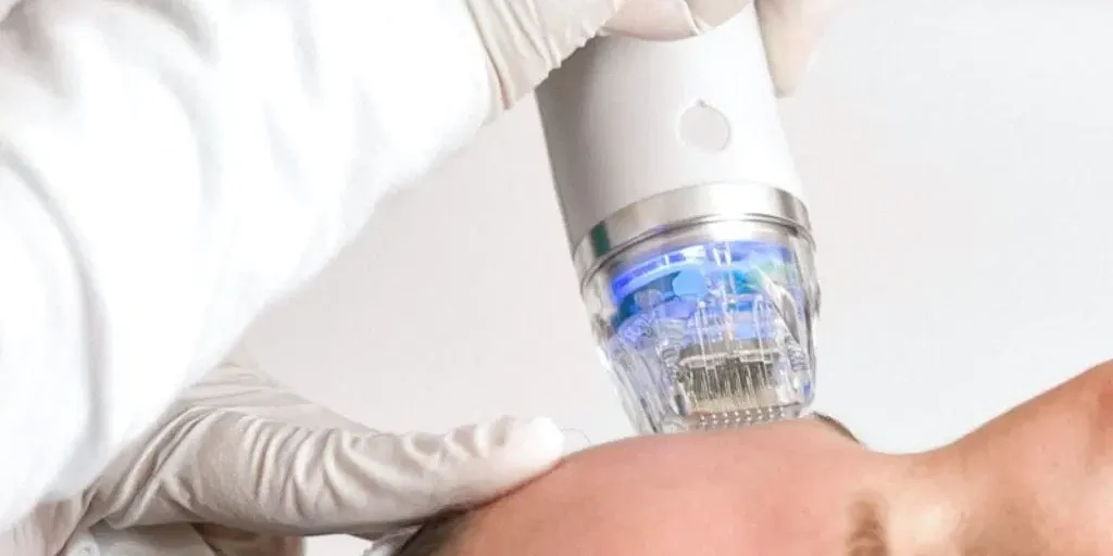 Radiofrecuencia fraccionada con micro agujas Presentamos nuestro innovador servicio de Radiofrecuencia Fraccionada con Microagujas en la Clínica del Dr. Juan Mendieta