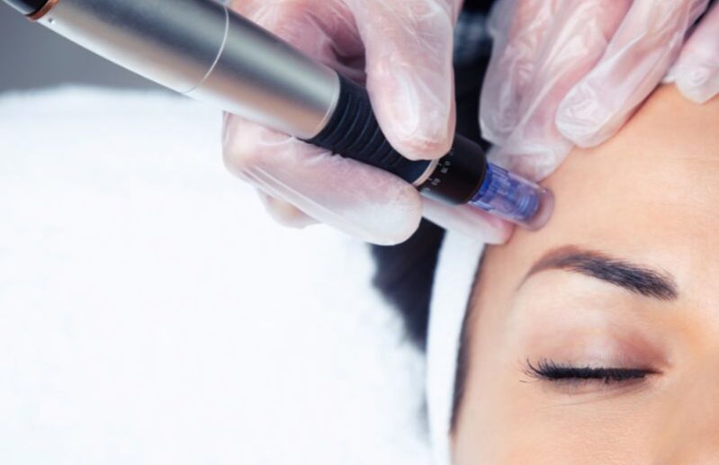 Dermapen
