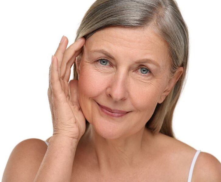Flacidez facial