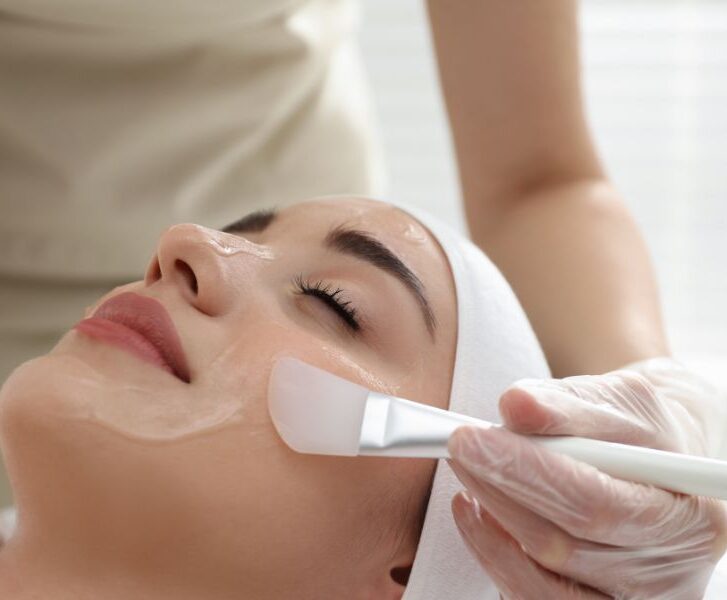 Peeling químico