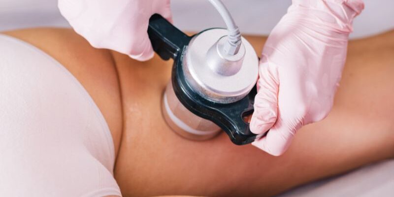 No necesitarás tiempo para recuperarte ni infiltraciones. Los tratamientos con radiofrecuencia contrâge son una solución ideal para mejorar tu apariencia sin cirugía, con tratamientos no invasivos, sin dolor y de manera segura.