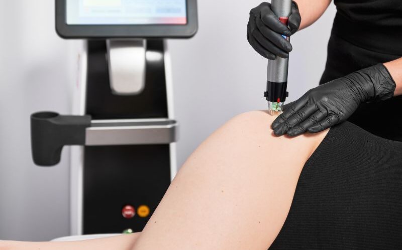 Presentamos nuestro innovador servicio de Radiofrecuencia Fraccionada con Microagujas en la Clínica del Dr. Juan Mendieta