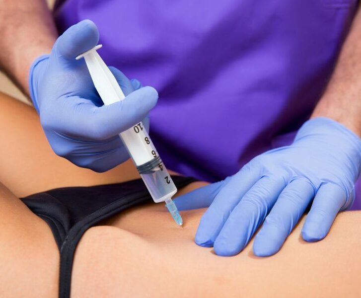 Mesoterapia corporal La mesoterapia corporal del Dr. Mendieta utiliza microinyecciones estratégicas para combatir celulitis y grasa localizada, mejorando la textura de la piel y promoviendo una apariencia más firme y saludable. Este procedimiento indoloro activa la circulación y detoxifica tejidos, ofreciendo resultados visibles en poco tiempo.
