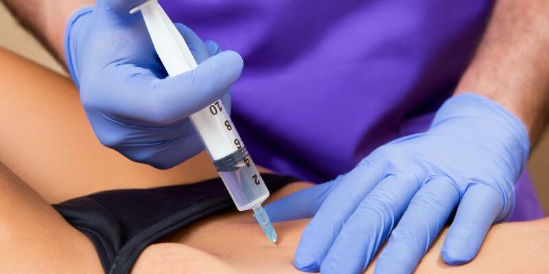 La mesoterapia corporal del Dr. Mendieta utiliza microinyecciones estratégicas para combatir celulitis y grasa localizada, mejorando la textura de la piel y promoviendo una apariencia más firme y saludable. Este procedimiento indoloro activa la circulación y detoxifica tejidos, ofreciendo resultados visibles en poco tiempo.