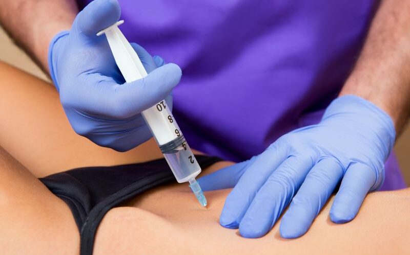 La mesoterapia corporal del Dr. Mendieta utiliza microinyecciones estratégicas para combatir celulitis y grasa localizada, mejorando la textura de la piel y promoviendo una apariencia más firme y saludable. Este procedimiento indoloro activa la circulación y detoxifica tejidos, ofreciendo resultados visibles en poco tiempo.