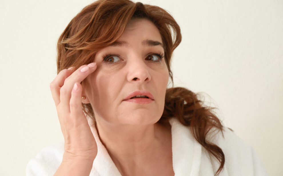 Elimina las ojeras Las ojeras se producen por la pérdida de volumen y oscurecimiento de los párpados inferiores, en muchos pacientes es genético, pero con el paso del tiempo la piel suele resecarse volviéndose más fina y frágil ocasionando la aparición.