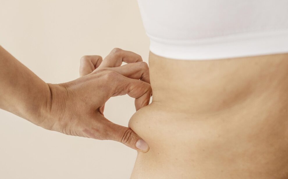 La grasa localizada puede acumularse en diversas áreas del cuerpo y a menudo, resulta resistente al ejercicio y difícil de eliminar. Para abordar este desafío, ofrecemos tratamientos no invasivos que promueven la eliminación natural de las células grasas.