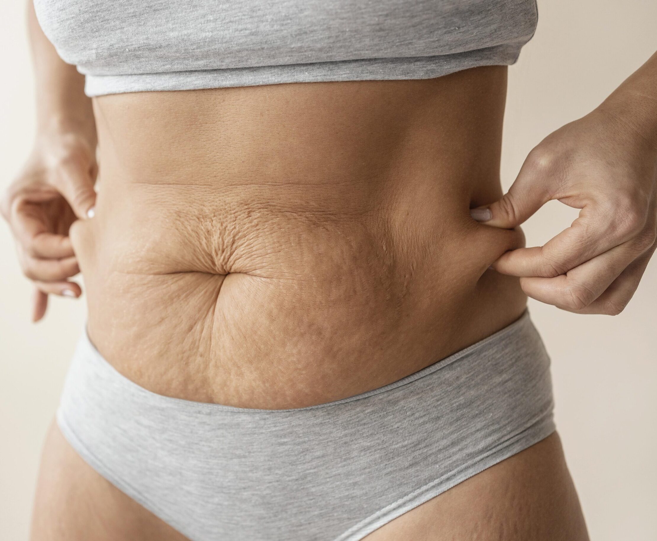 Flacidez corporal ¿Observas reducción de firmeza y flexibilidad en la piel? La Clínica del Dr. Mendieta dispone de la tecnología necesaria para restaurar la elasticidad de la piel y mejorar el tono muscular.