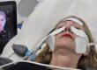 EMFACE Tratamiento para la flacidez facial Se trabaja en los pómulos, en la frente y en la papada Este tratamiento es una combinación de radiofrecuencia sincronizada y tecnología HIFES™ para combatir la flacidez facial y el descolgamiento muscular del rostro. EMFACE es un innovador tratamiento diseñado para abordar la flacidez facial y el descolgamiento muscular del rostro. Es único en su clase por ser el primer procedimiento que combina radiofrecuencia sincronizada (RF) y tecnología HIFES™, sin necesidad de agujas. Esta doble acción permite trabajar de manera simultánea tanto en la piel como en los músculos faciales, ofreciendo una solución efectiva y cómoda para rejuvenecer el rostro desde sus cimientos. El funcionamiento de EMFACE se centra en la mejora de la calidad muscular. A través de contracciones selectivas de los músculos y el aumento de la densidad y calidad de la estructura muscular, este tratamiento restaura el soporte natural de los tejidos faciales. Como resultado, el rostro recupera firmeza y elevación, devolviendo una apariencia rejuvenecida y redefinida, al tiempo que mejora la estructura subyacente de manera segura y no invasiva.