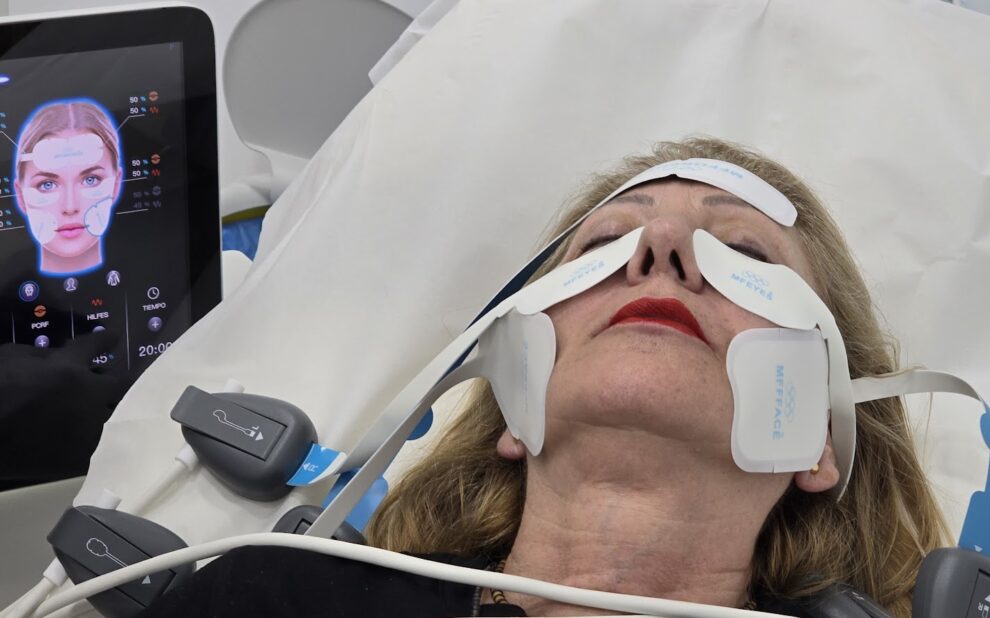 EMFACE Tratamiento para la flacidez facial EMFACE Tratamiento para la flacidez facial Se trabaja en los pómulos, en la frente y en la papada Este tratamiento es una combinación de radiofrecuencia sincronizada y tecnología HIFES™ para combatir la flacidez facial y el descolgamiento muscular del rostro. EMFACE es un innovador tratamiento diseñado para abordar la flacidez facial y el descolgamiento muscular del rostro. Es único en su clase por ser el primer procedimiento que combina radiofrecuencia sincronizada (RF) y tecnología HIFES™, sin necesidad de agujas. Esta doble acción permite trabajar de manera simultánea tanto en la piel como en los músculos faciales, ofreciendo una solución efectiva y cómoda para rejuvenecer el rostro desde sus cimientos. El funcionamiento de EMFACE se centra en la mejora de la calidad muscular. A través de contracciones selectivas de los músculos y el aumento de la densidad y calidad de la estructura muscular, este tratamiento restaura el soporte natural de los tejidos faciales. Como resultado, el rostro recupera firmeza y elevación, devolviendo una apariencia rejuvenecida y redefinida, al tiempo que mejora la estructura subyacente de manera segura y no invasiva.