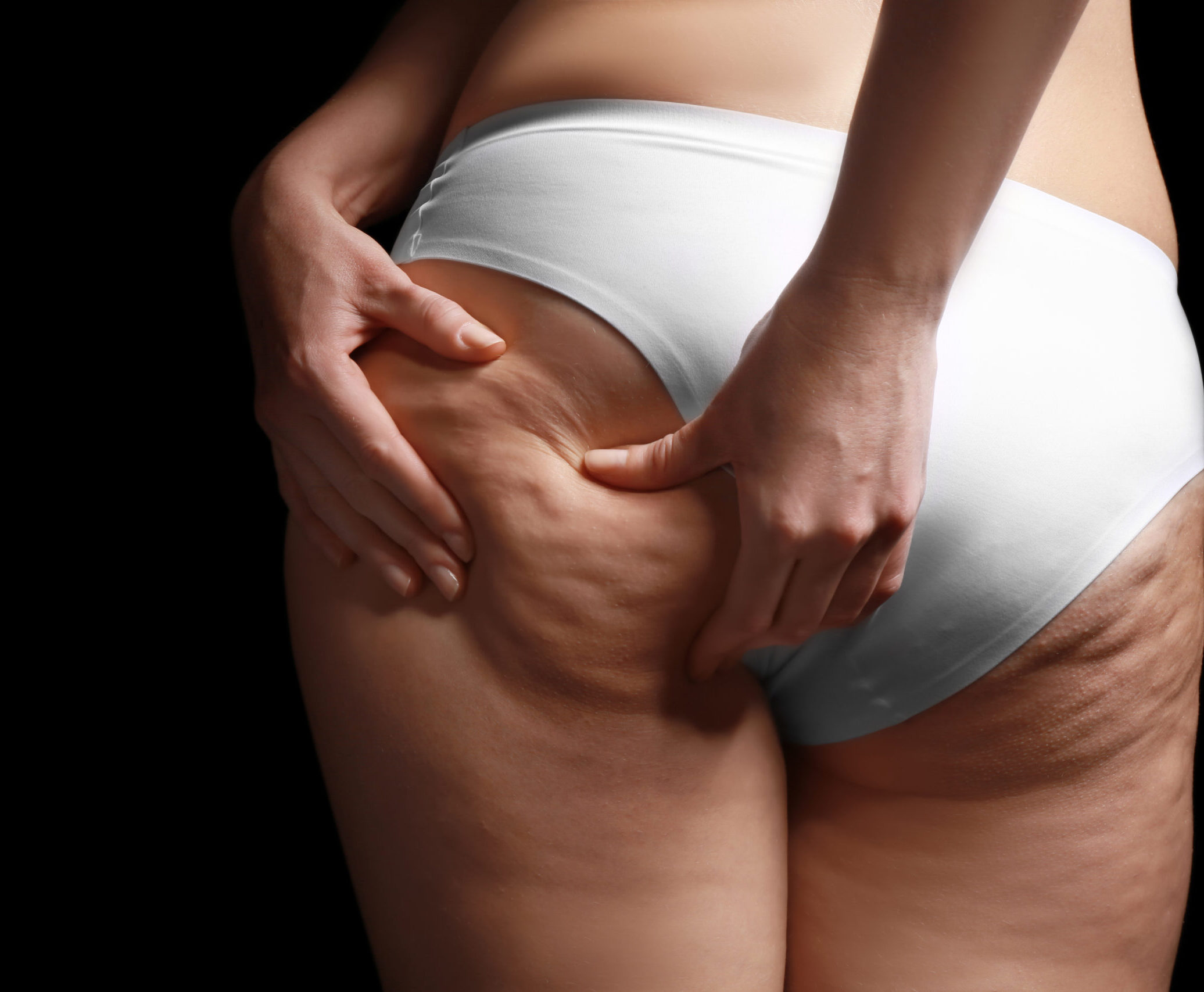 Celulitis Enfoque integral contra la celulitis Nuestra unidad corporal no quirúrgica ofrece soluciones adaptadas a cada persona, promoviendo una mejora efectiva y segura de la condición de la piel.