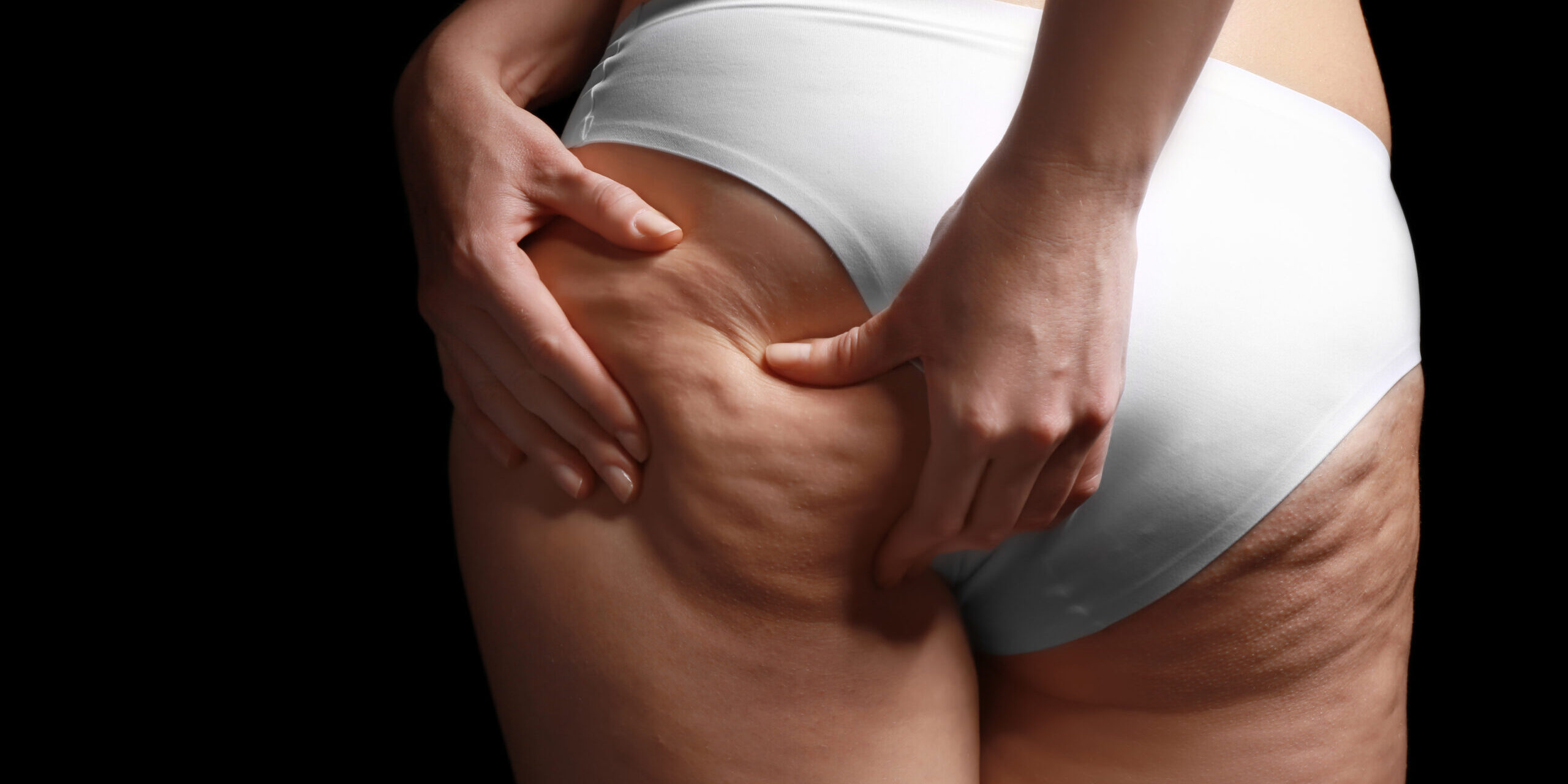 Enfoque integral contra la celulitis Nuestra unidad corporal no quirúrgica ofrece soluciones adaptadas a cada persona, promoviendo una mejora efectiva y segura de la condición de la piel.