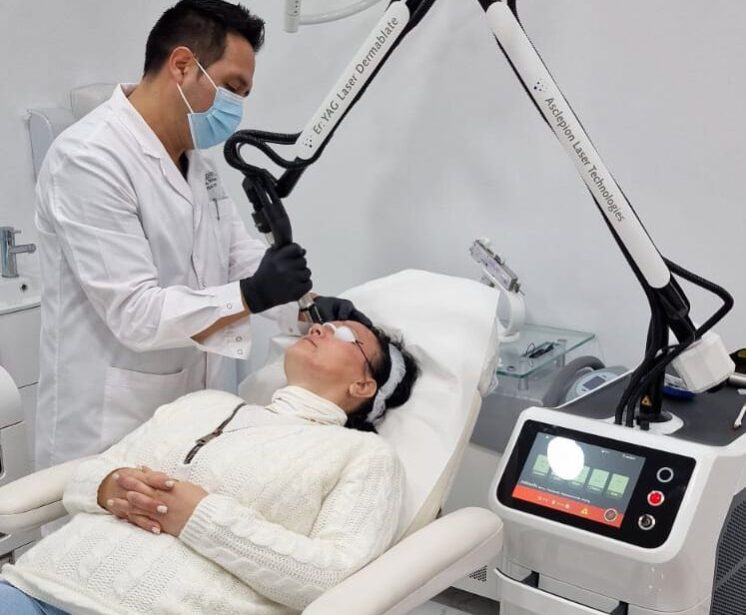 Láser dermablate En Clínica Dr. Mendieta, ofrecemos un tratamiento de trasplante capilar con la técnica FUE Zafiro, destacada por su precisión y efectividad.