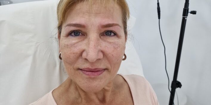 Transforma tu mirada con nuestra micropigmentación Un antes y después que ilumina tu rostro En la Clínica Dr. Juan Mendieta, somos expertos en resaltar tu belleza natural, y nuestra última micropigmentación de cejas es prueba de ello.