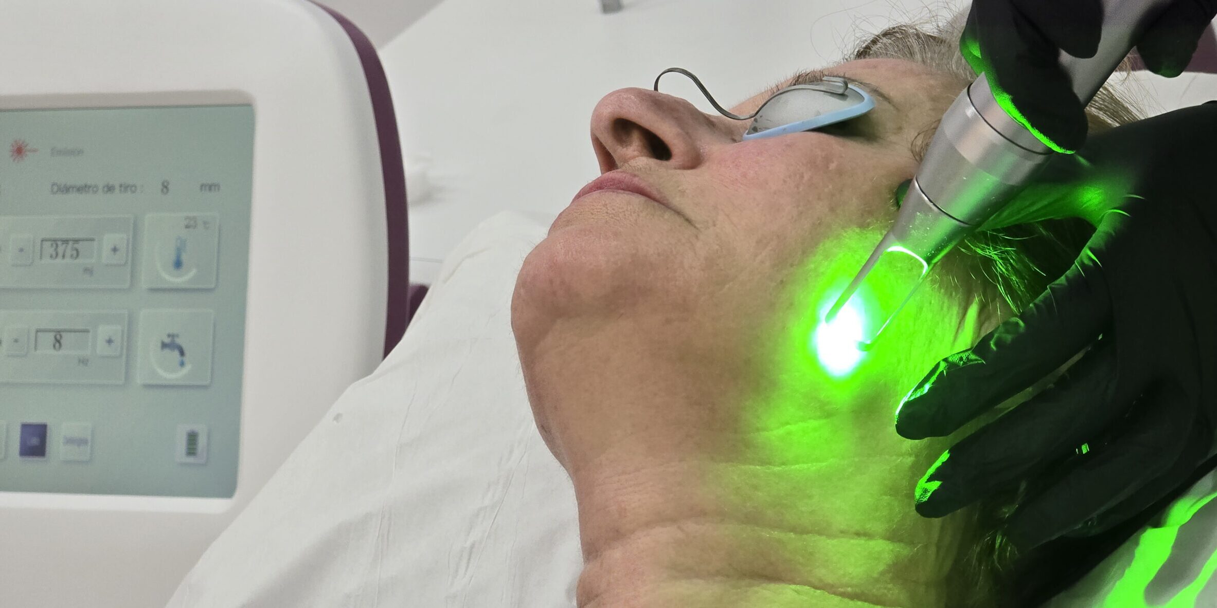 Rejuvenecimiento avanzado con Pico Láser El Pico Láser ha revolucionado el mundo de la medicina estética, posicionándose como una de las opciones más avanzadas y seguras para tratar una amplia variedad de problemas de la piel.