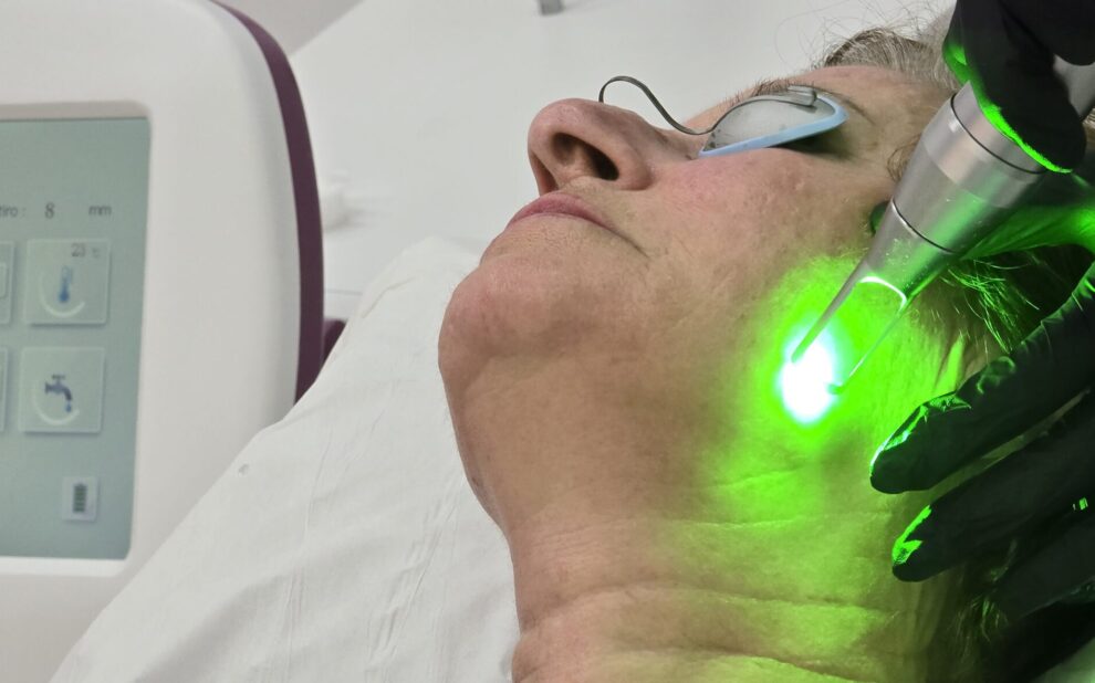 Rejuvenecimiento avanzado con Pico Láser El Pico Láser ha revolucionado el mundo de la medicina estética, posicionándose como una de las opciones más avanzadas y seguras para tratar una amplia variedad de problemas de la piel.