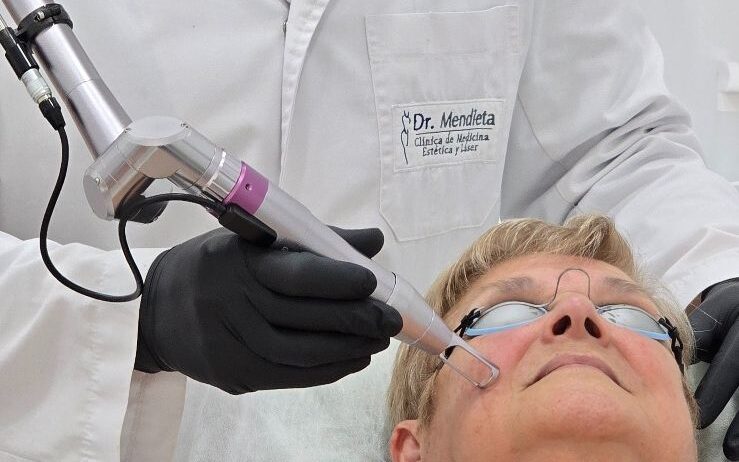 Pico Láser El Pico Láser es un revolucionario tratamiento dermatológico que utiliza pulsos de energía ultracortos y de alta potencia para renovar la piel de manera eficaz y segura.