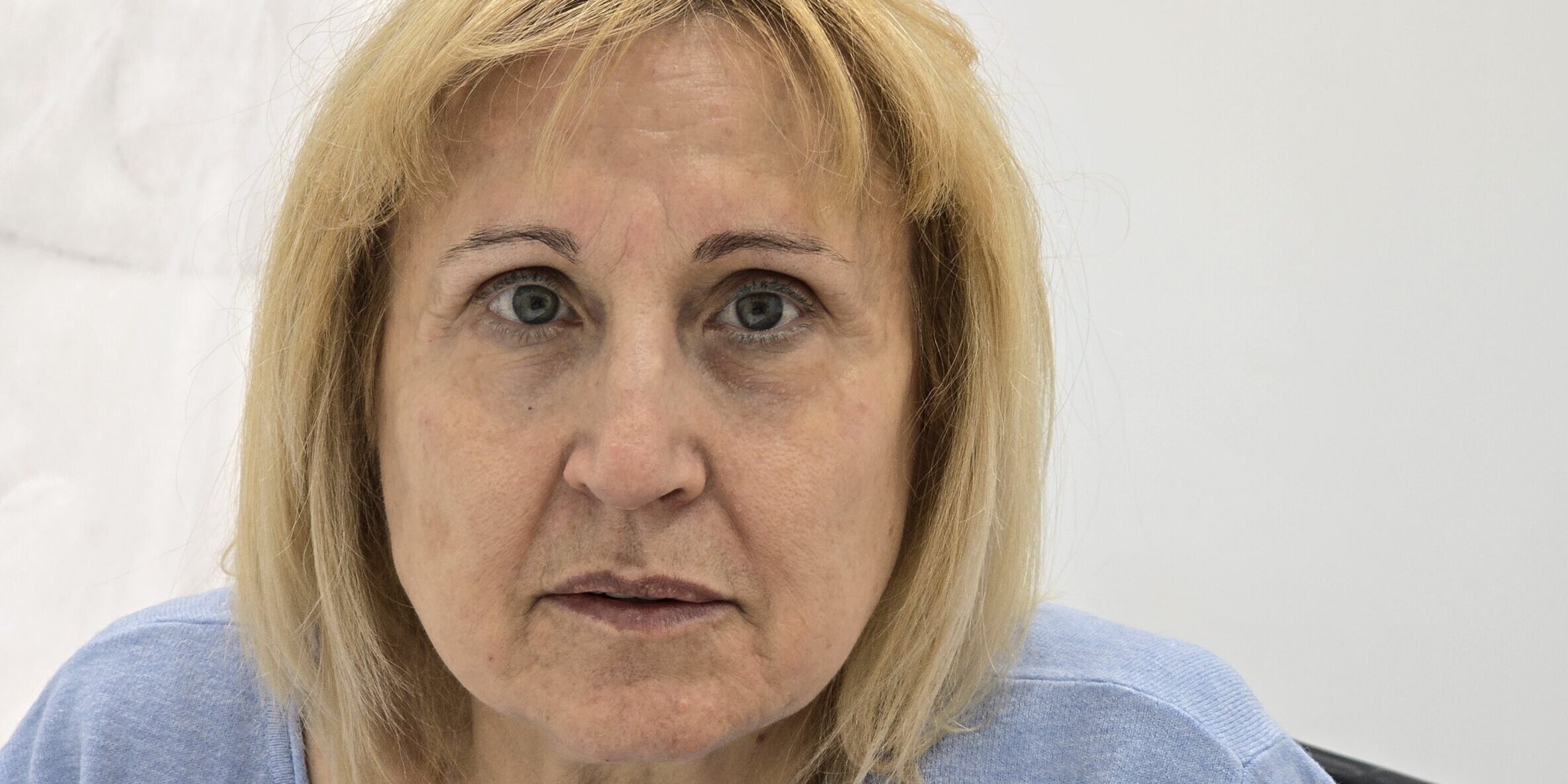 Caso de éxito en armonización facial en Clínica Dr. Juan Mendieta En Clínica Dr. Juan Mendieta, ubicada en Esplugues de Llobregat, nos enorgullece de ofrecer soluciones estéticas avanzadas que realzan la belleza natural de nuestros pacientes. Hoy queremos compartir un caso reciente de armonización facial, donde logramos resultados espectaculares con técnicas no invasivas.